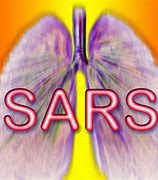 Image result for Severe Acute Respiratory Syndrome