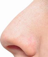 Image result for Swollen Inside Nose