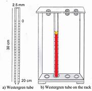 Image result for ESR Procedure