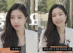 Image result for Naeun Plastic Surgery