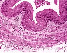 Image result for Ureter Histology Slides Labeled