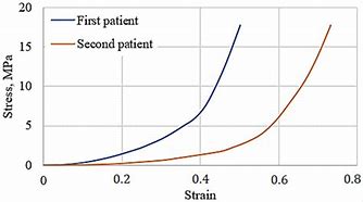 Image result for Meniscus Stress