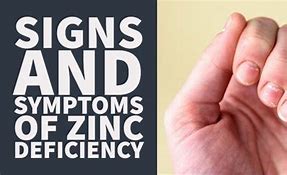 Image result for Zinc On People's Faces