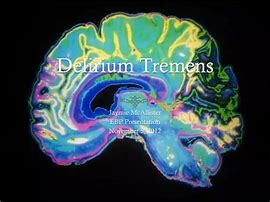 Image result for Delirium Tremens