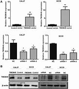 Image result for Il-12 qPCR