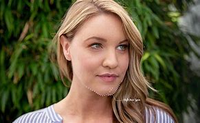 Image result for What Is Cleft Chin