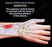 Image result for Extensor Pollicis Brevis