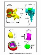 Image result for Dorsal Spine View