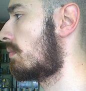 Image result for Cheek Beard