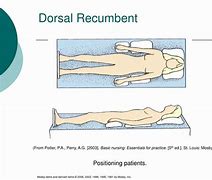 Image result for Dorsal Recumbent Position