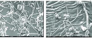 Image result for Fungal Hyphae and Spores