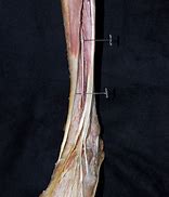 Image result for Anterior Tibial Artery