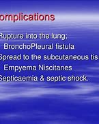 Image result for Thoracic Empyema On Percussion