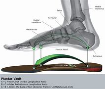 Image result for 3 Arches of the Foot