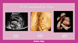 Image result for Baby Scan 3D 4D