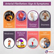 Image result for Vagal AFib Symptoms