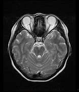 Image result for MRI Scanner