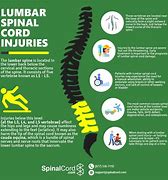 Image result for L5 Lumbar Vertebrae