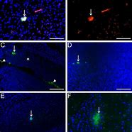 Image result for Cd45 Brain