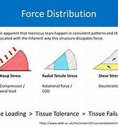 Image result for Meniscus Stress