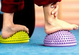 Image result for Arch Collaps Feet