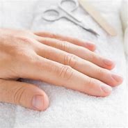 Image result for Finger Cancer