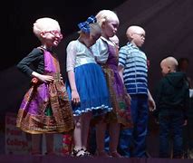 Image result for Albino Child in Pagent