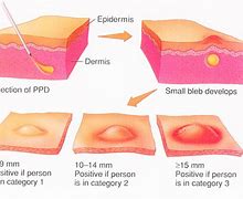 Image result for PPID Test Kit