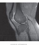 Image result for Lateral View of Knee Joint