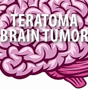 Image result for Teratoma Brain Tumor