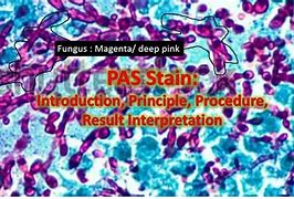 Image result for Periodic acid-Schiff Stain