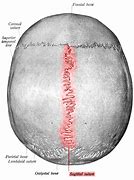 Image result for Midline Suture