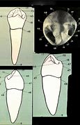 Image result for Mandibular 1st Premolar