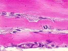 Image result for Micro Tears in Muscle Fiber Under Microscopes