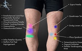 Image result for Left Side Knee Pain