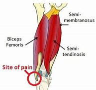 Image result for Lateral Knee Pain with Internal Rotation