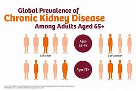 Image result for Chronic Kidney Disease