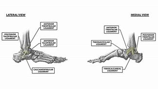 Image result for Area Distal to Lateral Malleolus