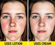 Image result for Irritated Skin On Face