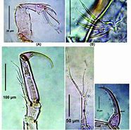 Image result for Dicot Embryo Development