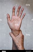 Image result for Hand Athritus Pain