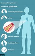 Image result for Coronary Artery Disease