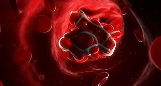 Image result for Blood Clotting