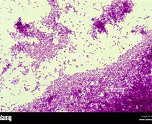 Image result for Bacterium Mycobacterium Tuberculosis