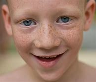 Image result for Interesting Faces Freckles