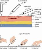 Image result for Subcutaneous Injection