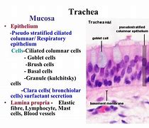 Image result for Small Granule Cells