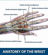 Image result for Extensor Tendon Hand Wrist Brace