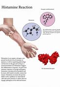 Image result for Post Pico Genesis Histamine Reaction