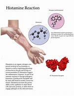 Image result for Histamine Reaction